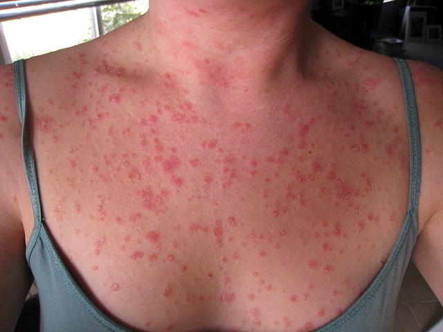 doesn't look any better today