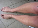 more dots on the legs